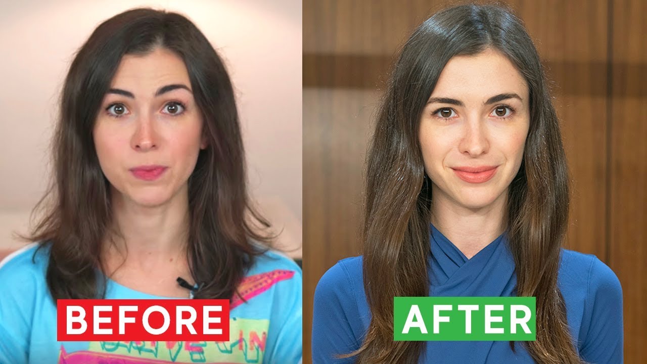HOW I STOPPED MY HAIR LOSS: WHAT WORKED FOR ME - YouTube