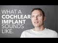 What does a cochlear implant sound like?