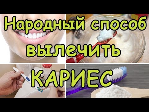 Кариес Лечение Дома Как вылечить кариес в домашних условиях и иметь красивую улыбку