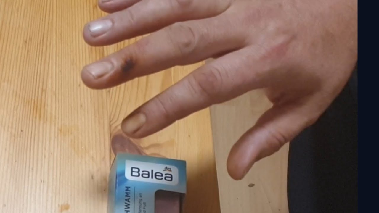 Wie Bekommt Man Gelbe Finger Vom Rauchen Weg Wie wäscht man sich die Finger vom Nikotin? Waschen Sie gelbe Finger