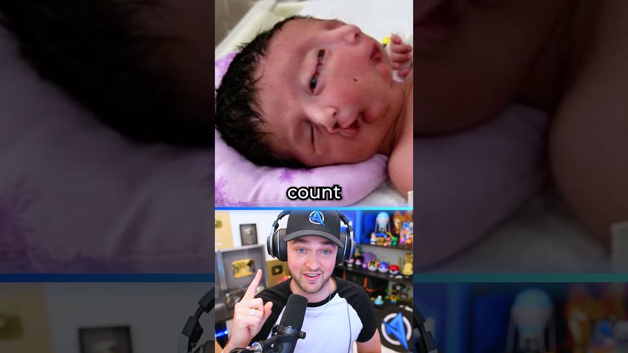 Insane Rare Body Features 