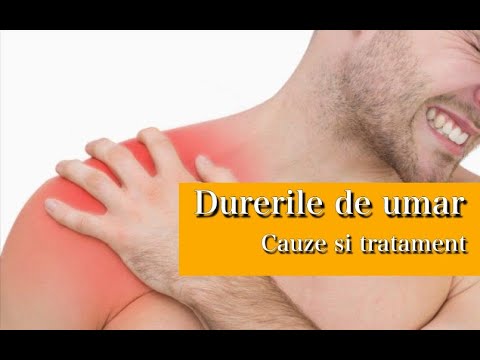 Video: Cum să opriți durerile de umăr: 13 pași (cu imagini)