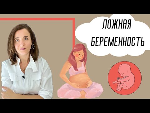 Видео: Насколько распространена ложная беременность?