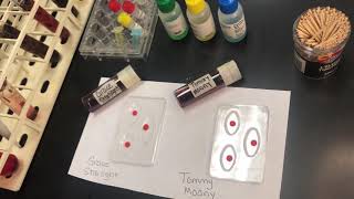 Blood Typing Lab