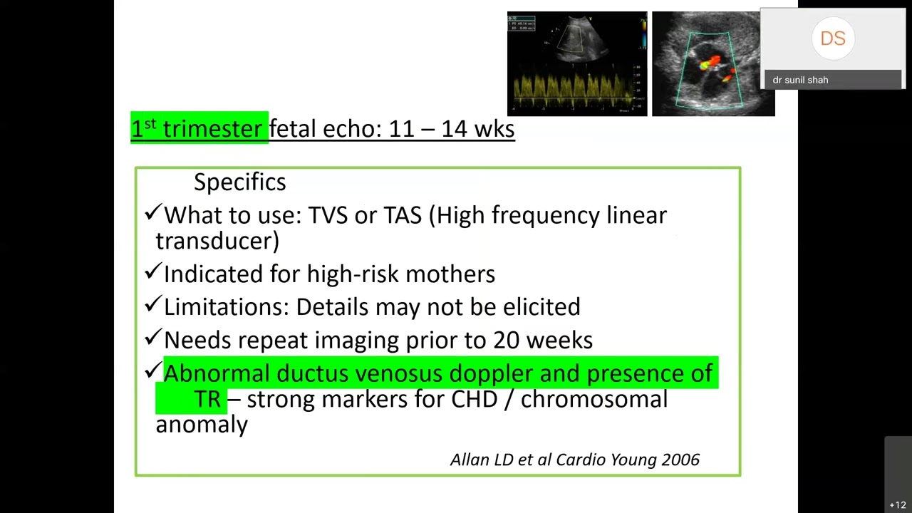 Fetal echo series #1 by Dr Sejal Shah