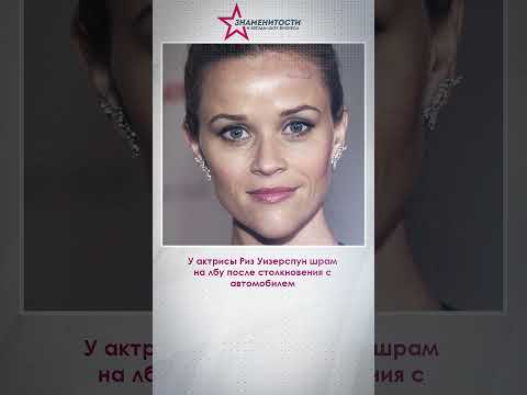 Знаменитости со шрамами