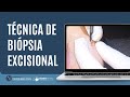 Biópsia Excisional - Curso Online de Cirurgia Ambulatorial