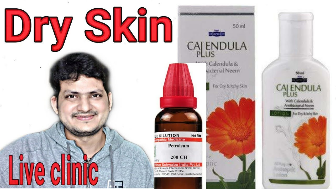 Dry Skin Homeopathic Medicine Petroleum Dr Kirti Vikram Singh Live Clinic 1203 26 11 2020 Youtube Homeopathic Medicine Homeopathic Medicine