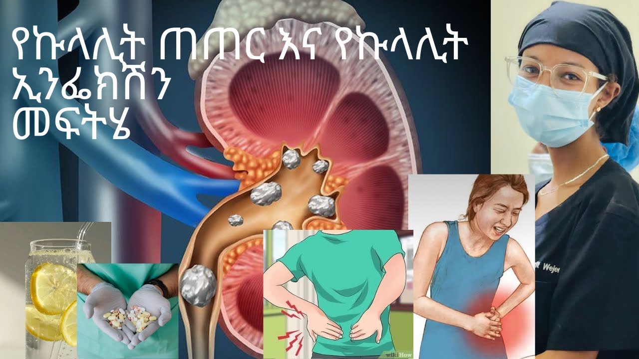የኩላሊት ጠጠር እና የኩላሊት ኢንፌክሽ መፍትሄ ( kidney stone and kidney infection) 