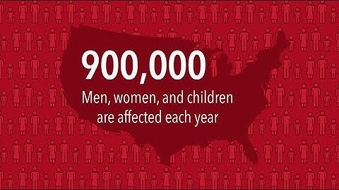 Public Service Announcement on Blood Clot Prevention - 60 seconds