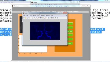 matlab image processing project codes | matlab image processing thesis codes