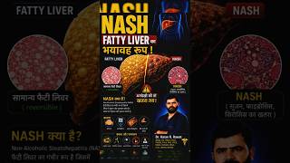 Fatty Liver Ka Dangerous Stage! 😱 NASH Se Ho Sakta Hai Liver Failure | Dr Karan R Rawat