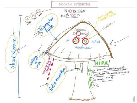 Video: Noonan-oireyhtymä - Syyt, Oireet Ja Hoito