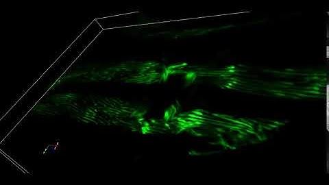 c.Elegans body wall and vulva muscles