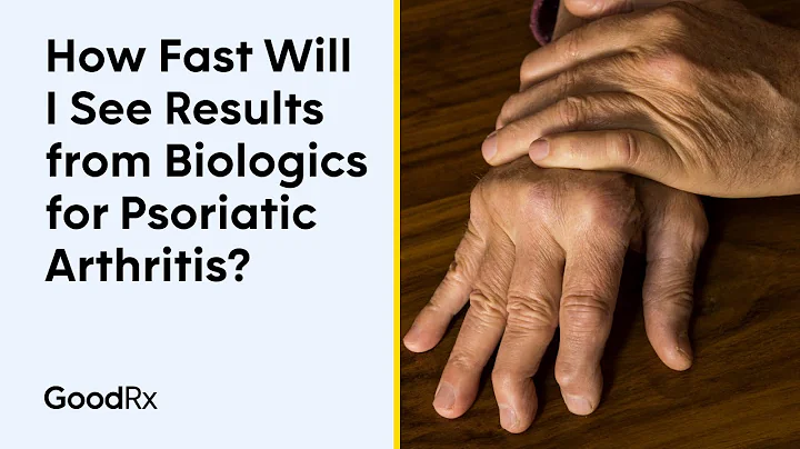 When To Expect Results From Using Biologics To Treat Psoriatic Arthritis | GoodRx