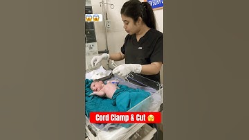 Cord clamp and cut😱#Shorts#viral#newborn
