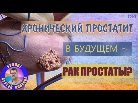 Хронический простатит в будущем рак простаты?