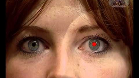 ophthalmoscopy video