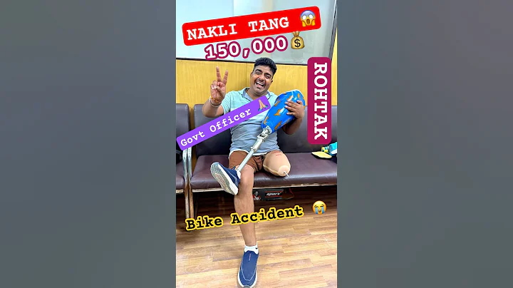 Above Knee Prosthesis | Ossur Pneumatic Knee Joint | Ottobock 3R80 | Ossur Liner | #ossur #ottobock