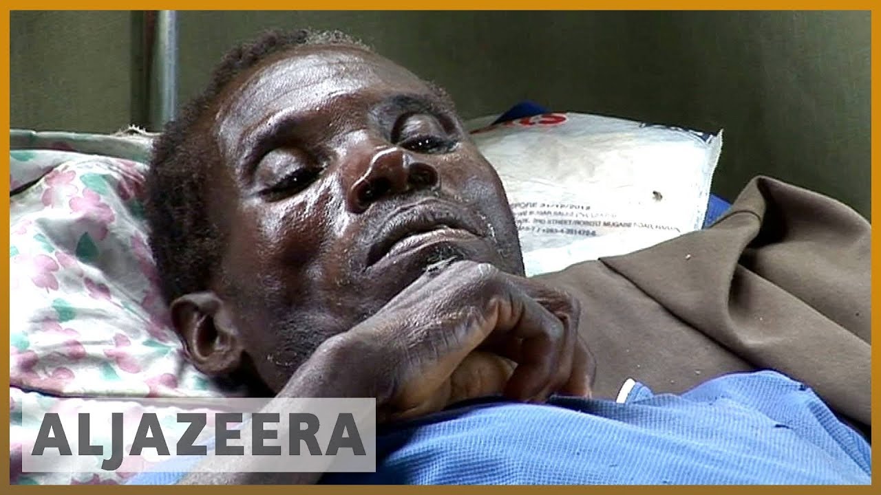 Zimbabwe declares state of emergency in cholera outbreak