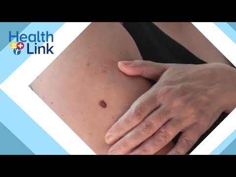 Are You At Risk? The Link Between Clobetasol And Cancer