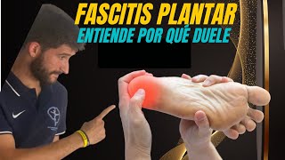 FASCITIS PLANTAR. Entiende por qué duele