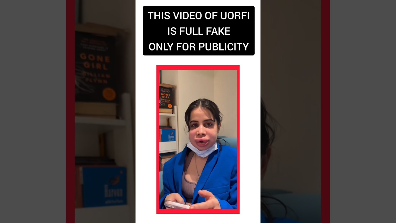 uorfi face surgery gone wrong 😳😱