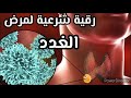رقية خاصة بأمراض الغدد اثر العين والحسد والسحر
