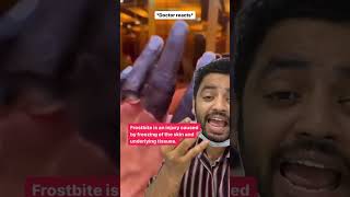Doctor Reacts Frostbite