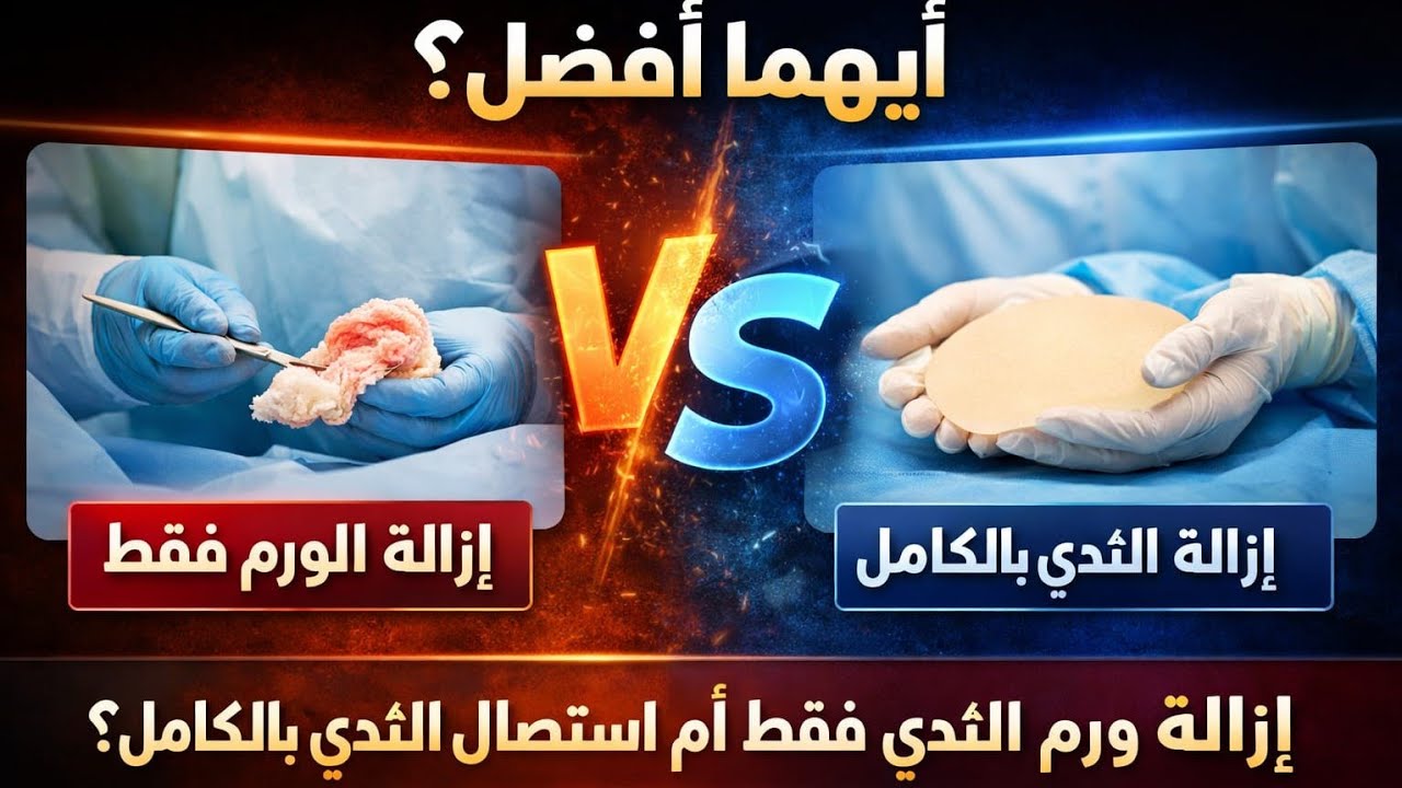هل لازم نستأصل الثدي بالكامل ولا ممكن نستأصل الورم فقط