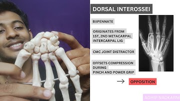 INTRINSIC MUSCLES OF THUMB( HAND  COMPLEX BIOMECHANICS)Physiotherapy
