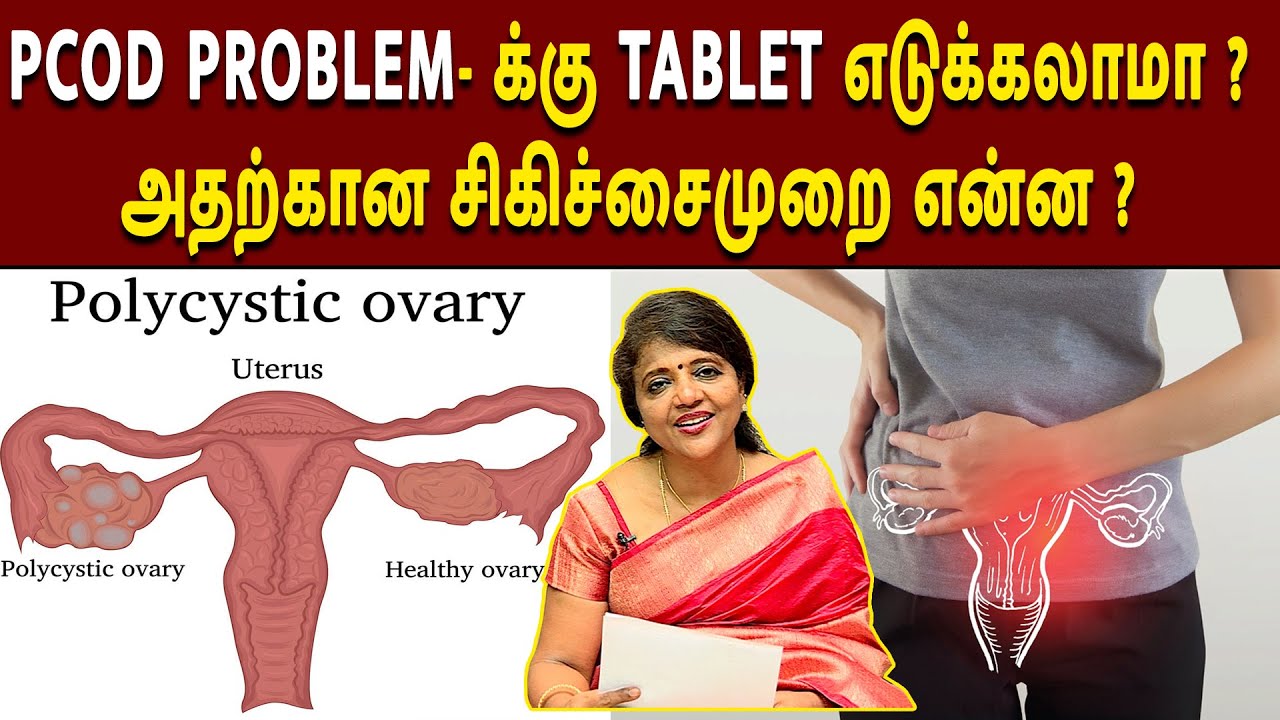 PCOD PROBLEM- க்கு TABLET எடுக்கலாமா ? அதற்கான சிகிச்சைமுறை என்ன ...