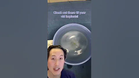 Today I Removed 15 Year Old Saline Breast Implants! #shorts #breastimplants