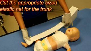 Evaluation/Treatment of the Child with a Burn Injury, Trunk Burn