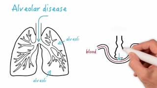 Airway disease versus alveolar disease