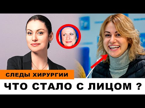 АННА КОВАЛЬЧУК: 'КРАСАВИЦА' ИЛИ 'ПЛАСТИЧЕСКИЙ ЭКСПЕРИМЕНТ'?