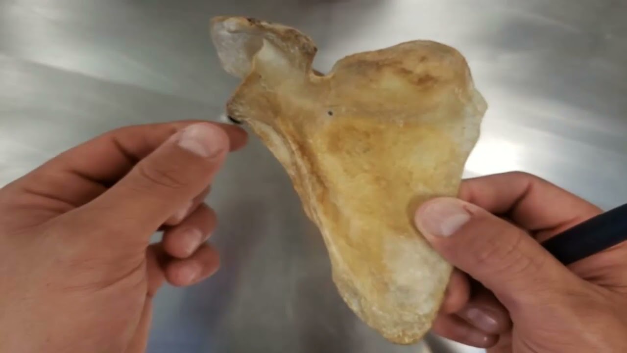 VÍDEO AULA PRÁTICA OSSOS DO MEMBRO SUPERIOR PARTE 1   CLAVÍCULA E ESCÁPULA