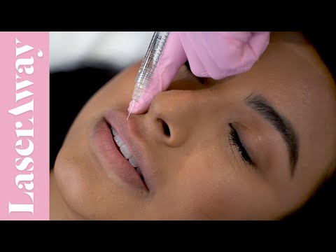 Video: Hľadáte Najlepší Dovolenkový Predaj? Môžu Byť Na Botoxe A Juvederme