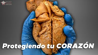 El PEOR tipo de enfermedad del corazón y cómo prevenirla...