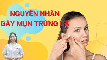 Nguyên Nhân Gây Mụn Trứng Cá Theo Chuyên Khoa