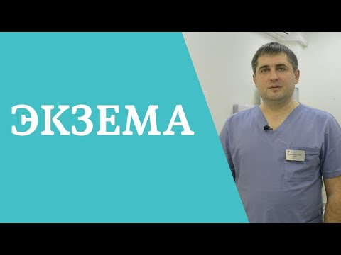 Экзема