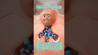 पिंपल 🗣️🔥 - #pimples#pores#sebum#skincare#skincareproduct#bacteria#period#pcod#oilyskin#lifestyle