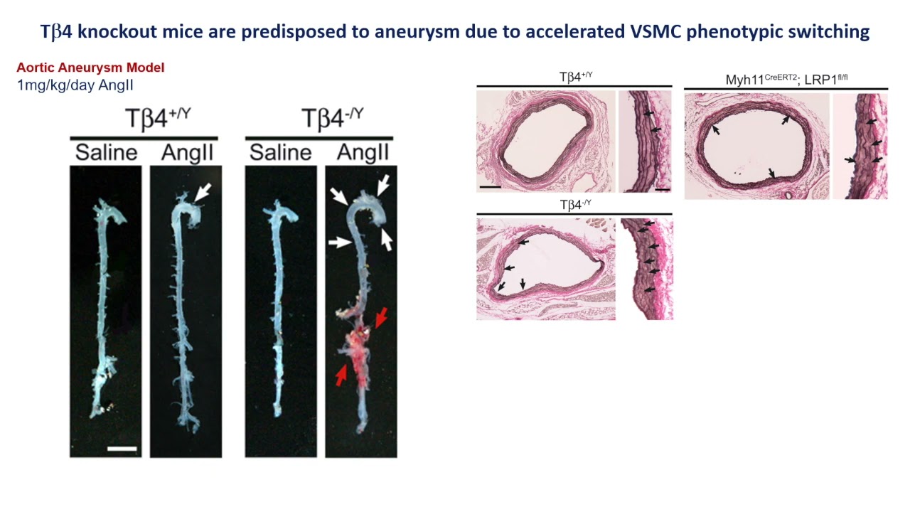 bpc 157 aneurysm Thymosin β4 protects against aortic aneurysm