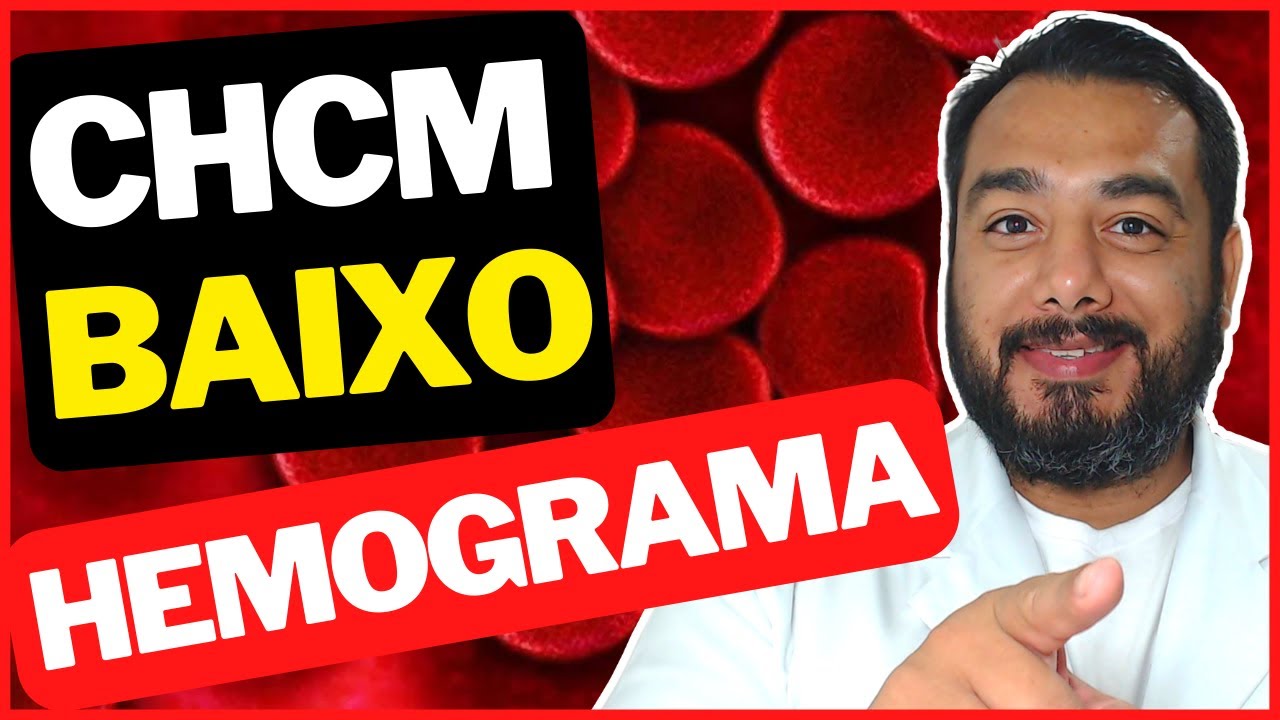 CHCM Baixa ou Alta (Concentração de Hemoglobina Corpuscular Média) Hemograma Índice CHCM Baixa ou Alta (Concentração de Hemoglobina Corpuscular Média) Hemograma Índice