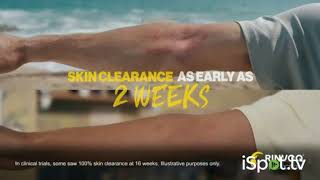 RINVOQ Disrupts My Skin: Potter and Kayaker commercial 2026