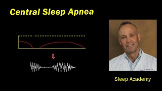 Central Sleep Apnea Explained | Sleep Academy Preview
