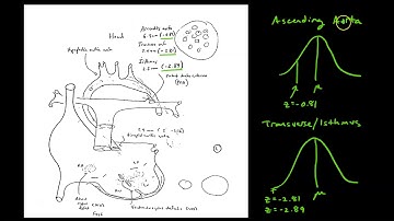 Module 3 Example of Zscore/Percentile/EmpiricalRule: Video #10
