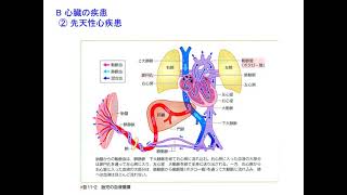 Web講義病理学第8回（第11章循環器系の疾患）（20211125）