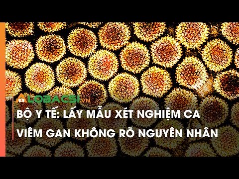 Video Bộ Y tế: Lấy mẫu xét nghiệm ca viêm gan không rõ... - youtube