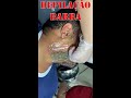 Depilando a Barba com cera elástica | parte 2